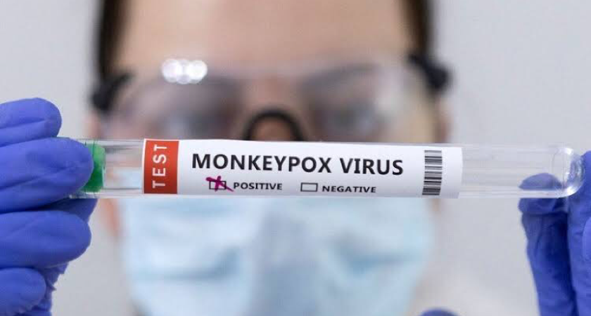 Teste da Varíola do Macaco